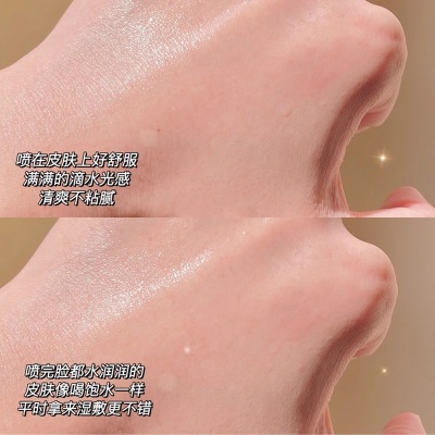 颐莲补水喷雾水破尿酸保湿补水修护镇定舒缓护肤水平衡爽肤水定妆